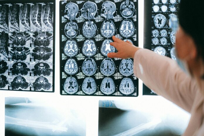 Scansione del cervello umano in colori brillanti su schermo medico