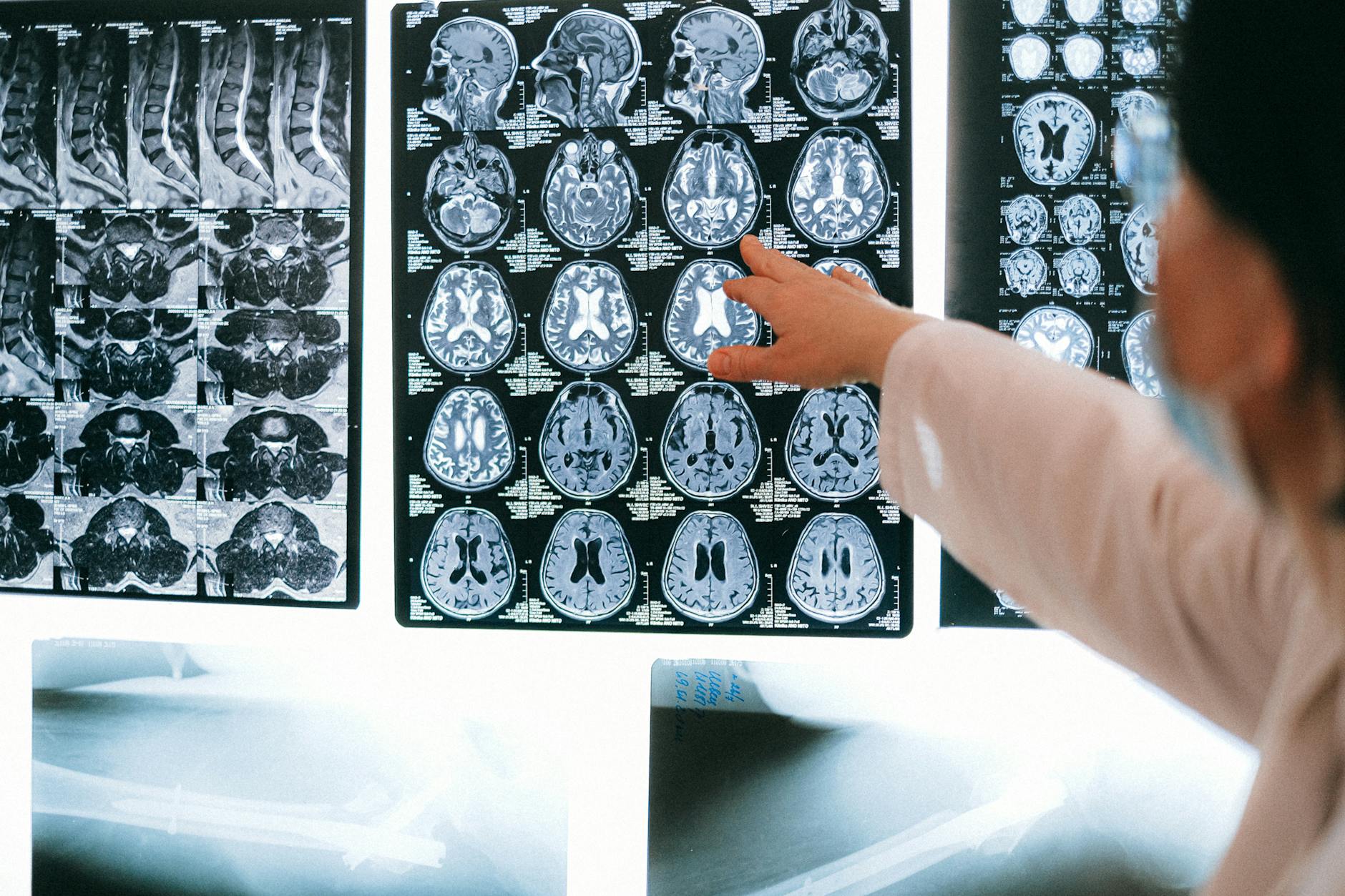 Scansione del cervello umano in colori brillanti su schermo medico