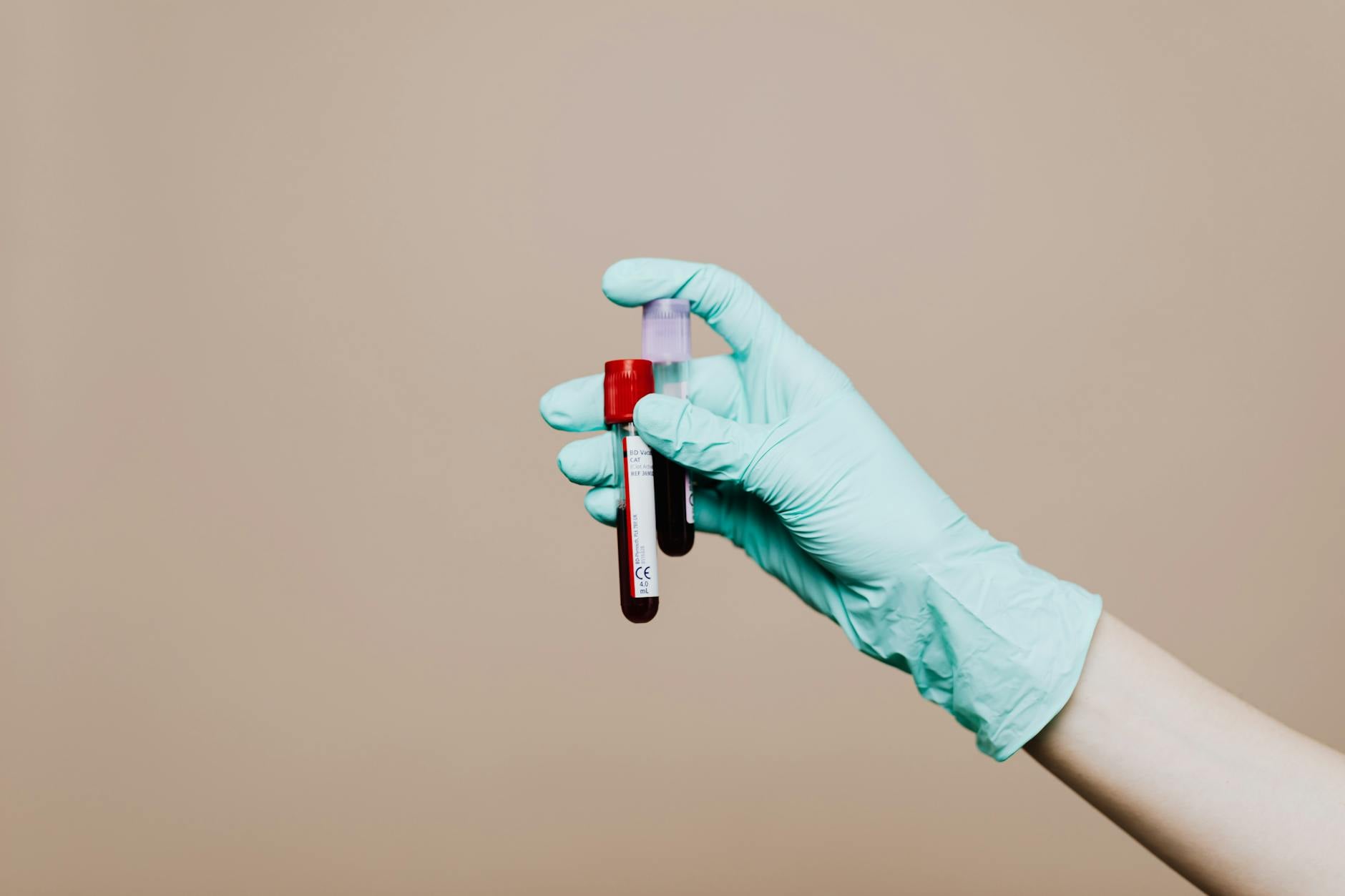 Laboratorio di ricerca medica sulla sclerosi multipla