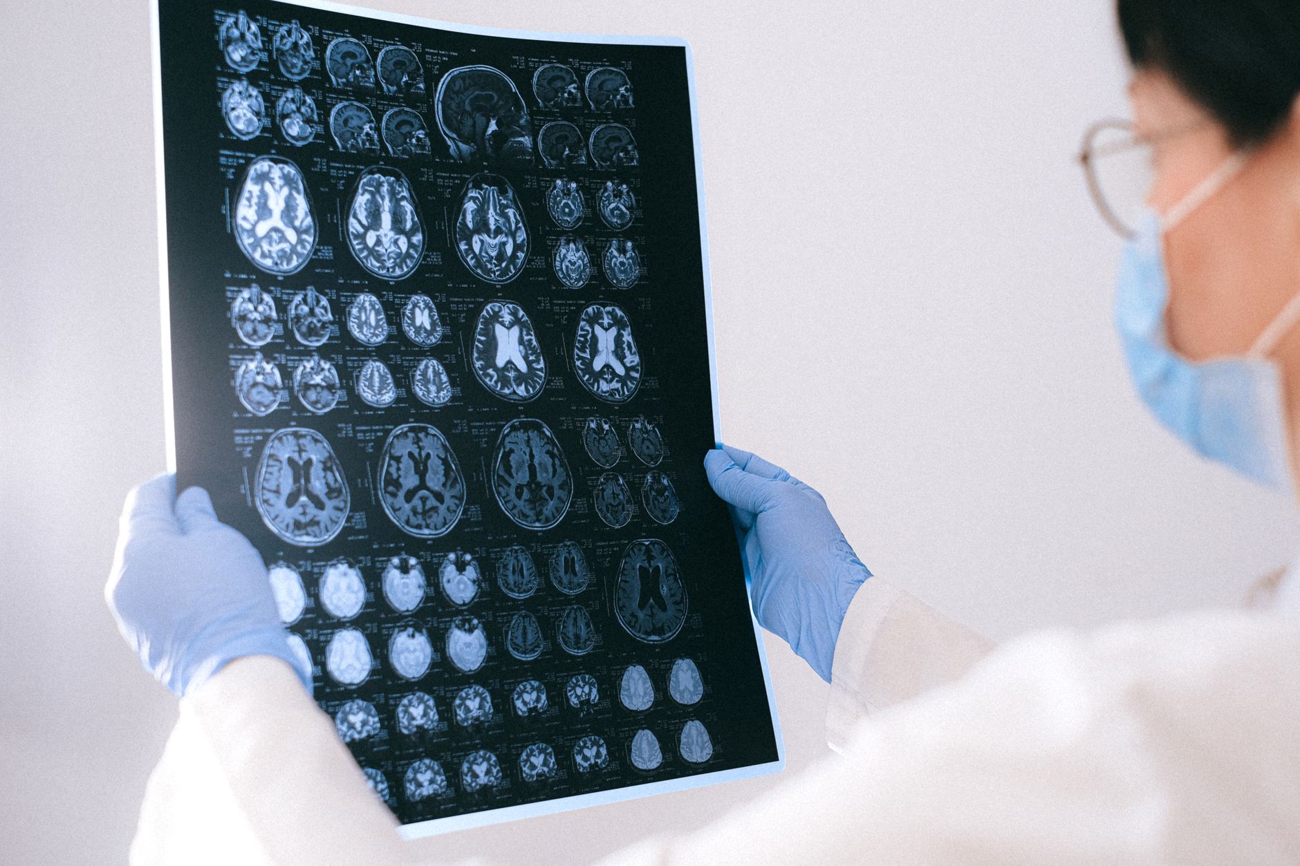 Modello tridimensionale del cervello umano