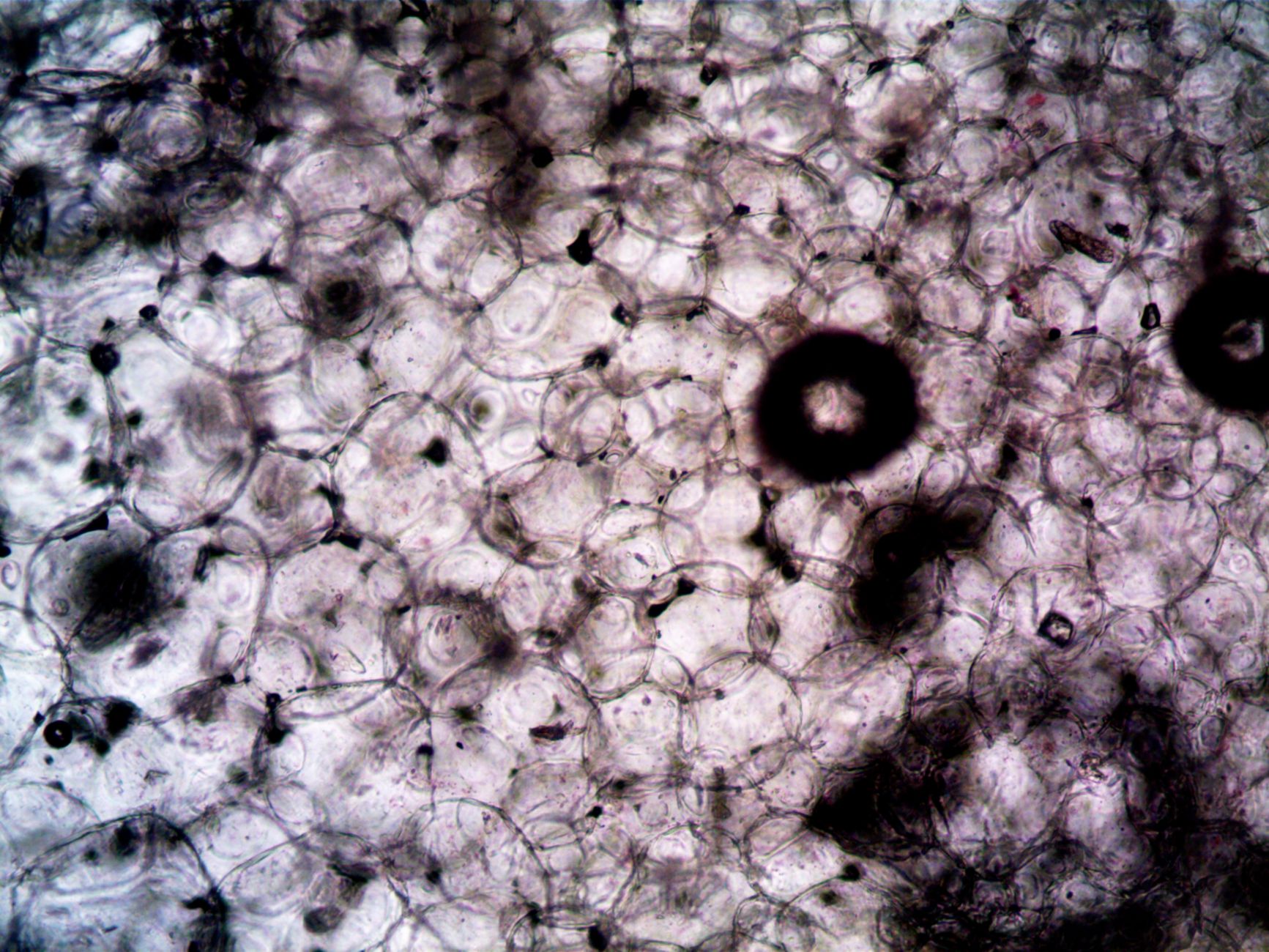 Ricercatrice al microscopio in un laboratorio medico