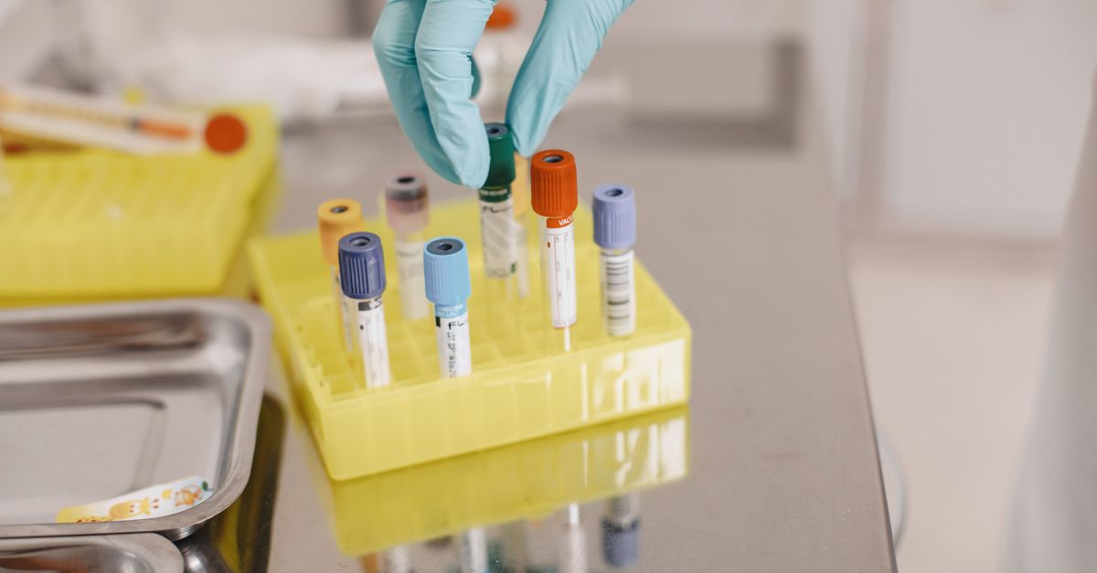 Provette per esami del sangue in un laboratorio medico