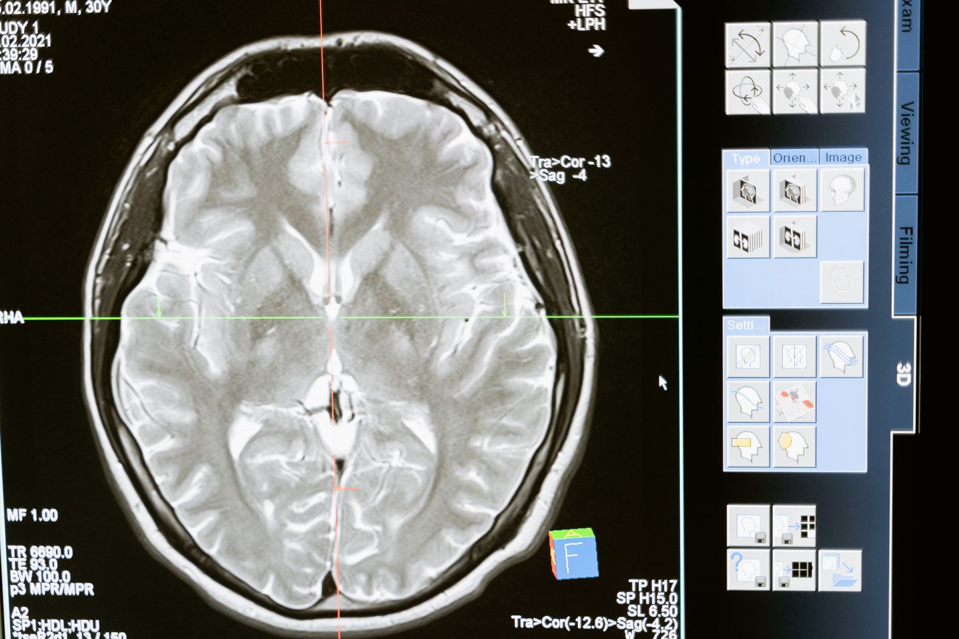 Ricercatore al microscopio in un laboratorio di neuroscienze