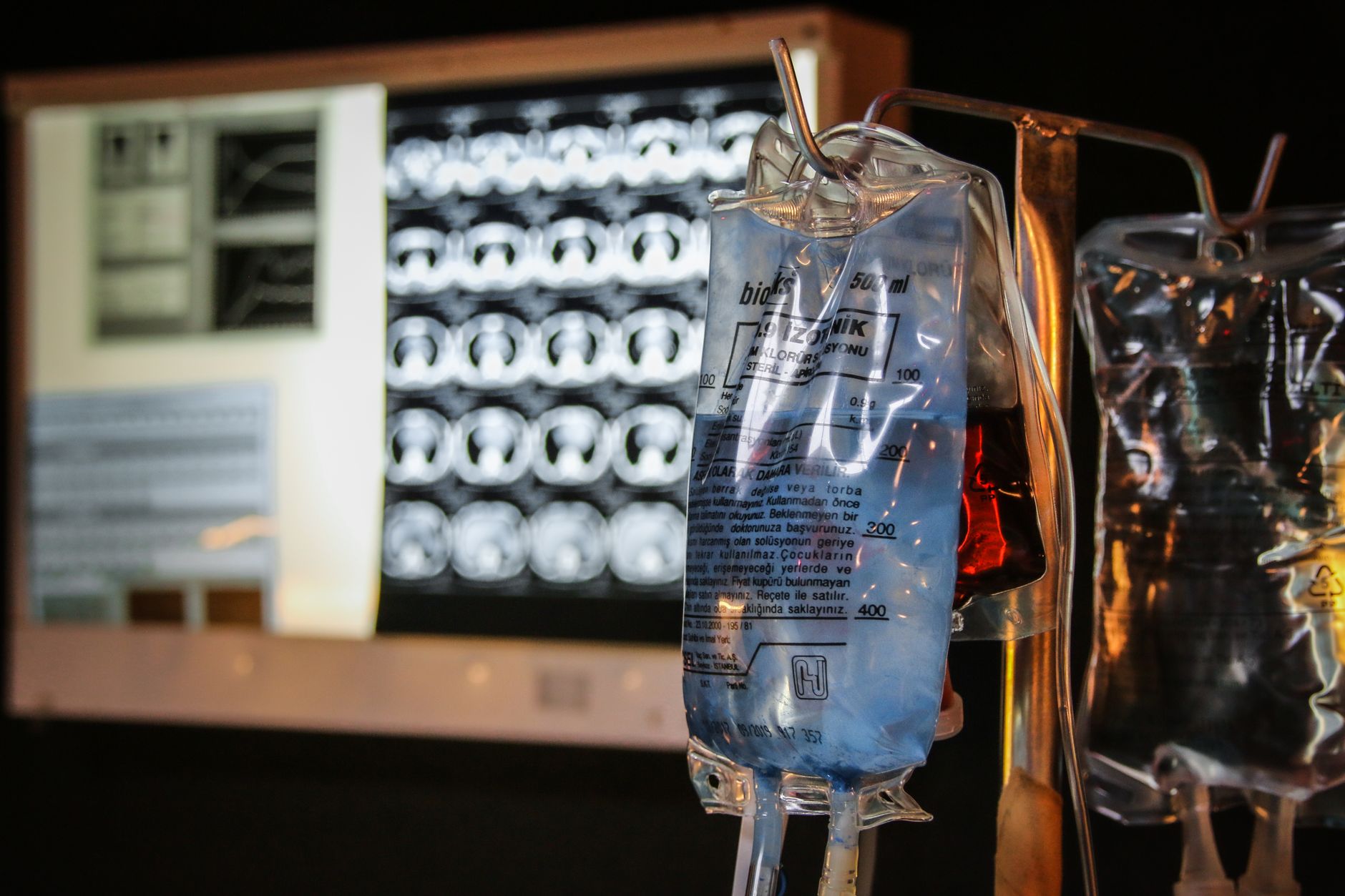 Analisi di immagini mediche al computer
