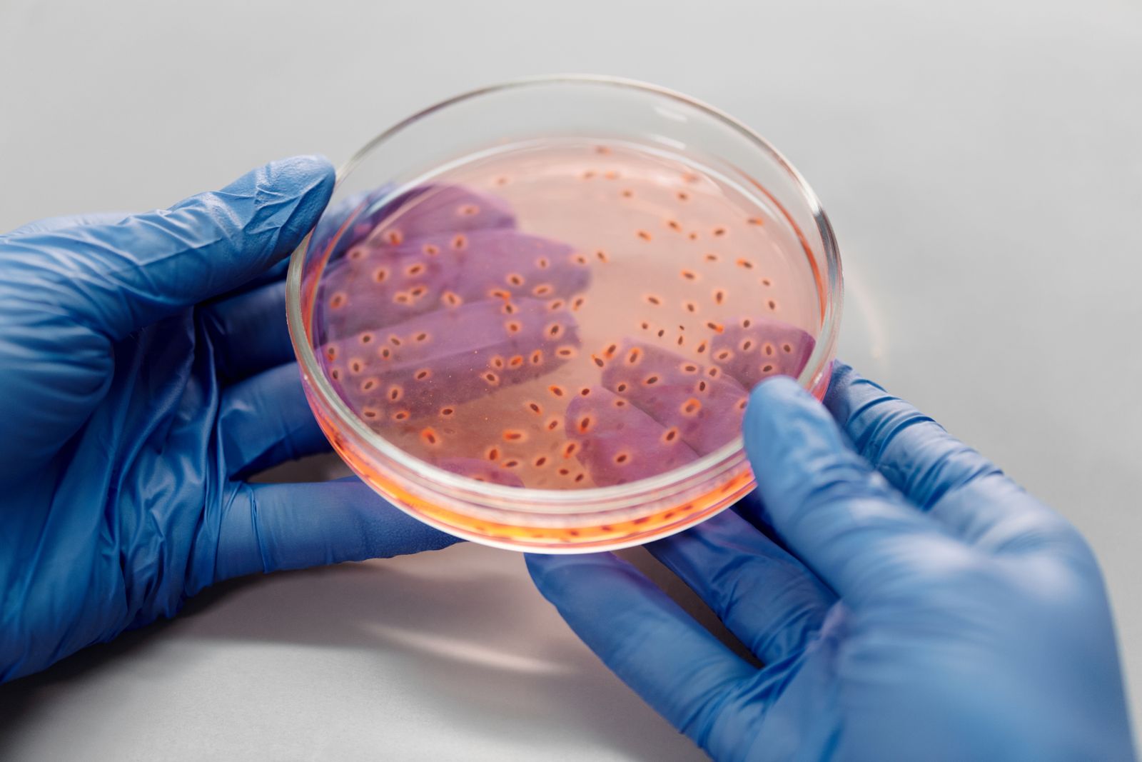 Mani con i guanti tengono una piastra di Petri con una coltura di batteri in laboratorio